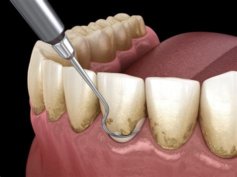 dentists that treat periodontal disease.